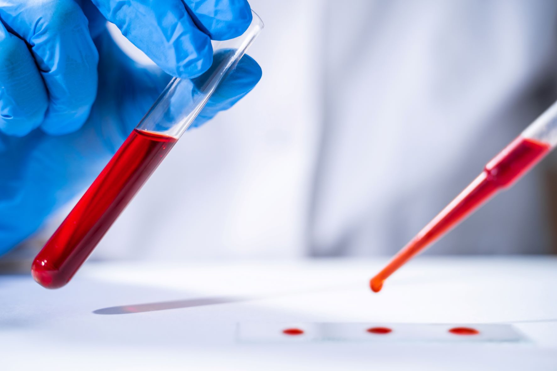 Blood test in a lab. Drops of blood for a test tube to a microscope plate.